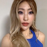 Ketika kamu suntik Botox secara reguler, kamu bisa melihat perbedaan dagu menjadi lebih kecil. Aku tidak bilang kalian harus dermal filler atau Botox. Aku hanya ingin membagi pengalaman dengan kalian semua. Aku hanya ingin jujur dengan apa yang aku lakukan, tuturnya bulan Juni lalu. Foto: Instagram @seyoung_1408