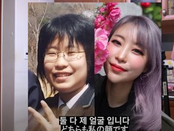 Kisah Aktris Reply 1988 Jalani Oplas, Totalnya Senilai Mercedes Benz S-Class