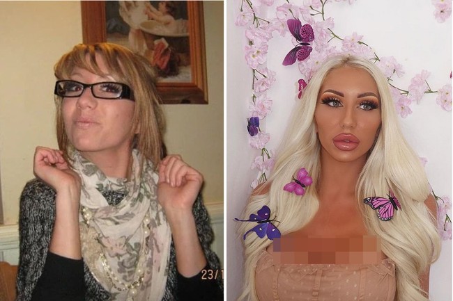 Sementara inilah penampilannya dulu. Charlie remaja adalah gadis yang kurus dan selalu pucat karena penyakit scoliosisnya. Foto: Instagram @charlieeebarbie