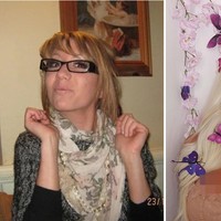 Sementara inilah penampilannya dulu. Charlie remaja adalah gadis yang kurus dan selalu pucat karena penyakit scoliosisnya. Foto: Instagram @charlieeebarbie