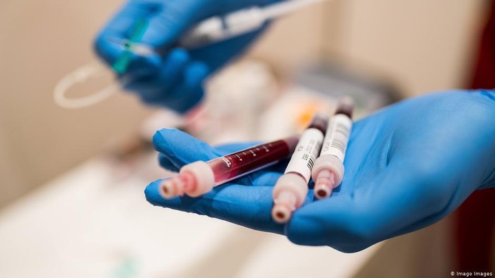 Antibodi Pada Bayi, Virus Corona Tetap Menyimpan Banyak Misteri