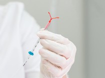 Heboh Studi Ungkap IUD Hormonal Berisiko Picu Kanker Payudara
