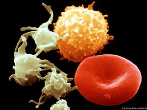 Biomarker Sinyal Peringatan Gejala Sakit Berat COVID-19 Ditemukan