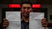 Dengan cara mereka memberikan surat kepada pihak sekolah bahwa menyetujui kegiatan sekolah belajar tatap muka. 