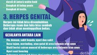 Gonnorhea dikenal juga dengan istilah kencing nanah.