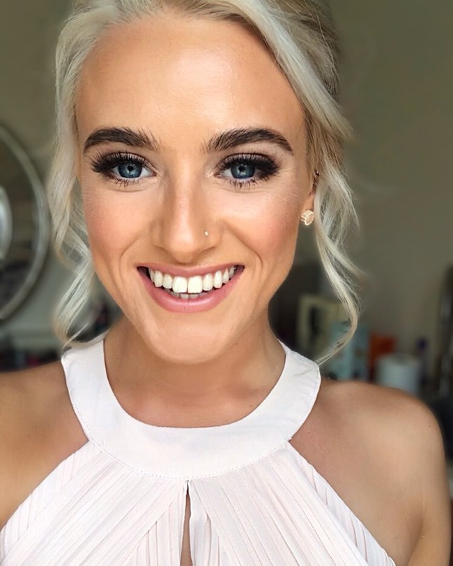 Adalah Jess Mackenzie, seorang influencer asal Skotlandia yang baru-baru ini mengejutkan follower ketika mengungkap kondisi asli wajahnya. Tak terlihat di kebanyakan postingan, ternyata wanita itu berjerawat parah. Foto: Instagram @_jessyoga