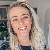 Dalam postingannya, Jess Mackenzien menambahkan tanda pagar #acnepositivity untuk memulai tren dengan harapan menormalisasi kulit berjerawat. Bisa menampilkan diri sendiri, ia merasa menemukan kehidupan Instagram yang baru. Foto: Instagram @_jessyoga