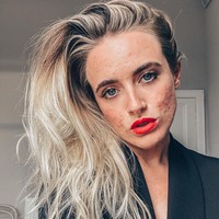 Jess mulai berjerawat sejak remaja yang keadaan semakin parah ketika dewasa. Wanita itu lalu didiagnosa menderita jerawat sistik parah. Diakuinya ia tentu tidak percaya diri dengan kondisi wjaah hingga membuatnya menangis. Foto: Instagram @_jessyoga