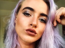 Kejutkan Follower, Selebgram Ungkap Kondisi Wajah Asli yang Jerawatan Parah