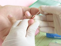 Langka! Golongan Darah P Ditemukan di China