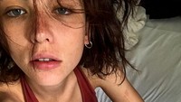 Selain itu Matilda juga menceritakan soal pengalamannya yang sempat mengidap anoreksia kala remaja. Dok. Instagram/matildadeangelis