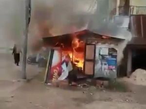 2 Bulan Dirawat, Suami yang Bakar Istri di Dumai Riau Belum Pulih