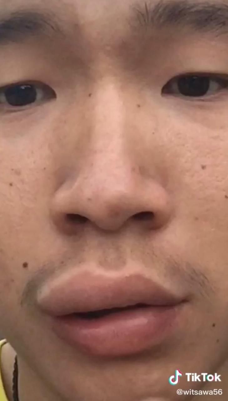 Ngakak! Makan Madu dari Sarangnya, Bibir Pria Ini Jadi Jontor