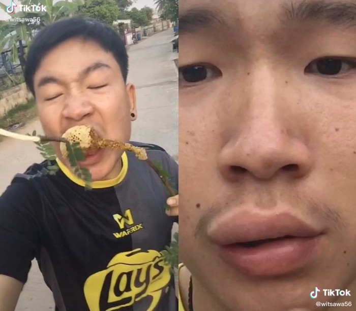 Ngakak! Makan Madu dari Sarangnya, Bibir Pria Ini Jadi Jontor