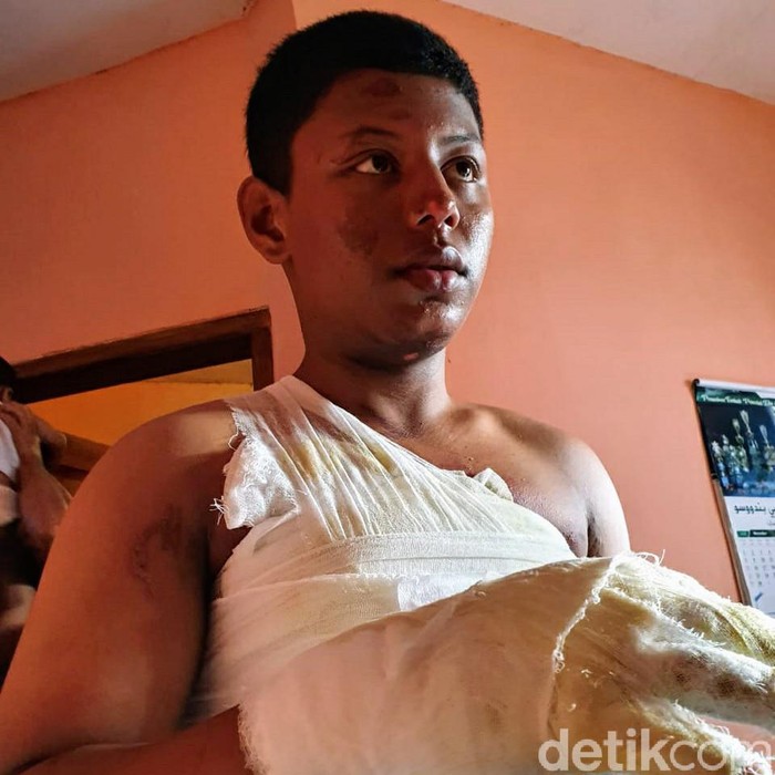 Seorang santri di sebuah Ponpes di Bondowoso diduga jadi korban penganiayaan teman-temannya. Korban mengalami luka-luka di sekujur tubuhnya.