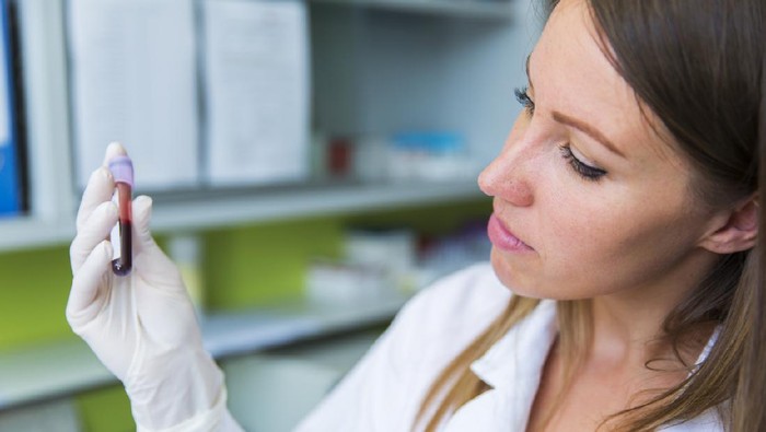 Cute young woman doctor holding vial with blood sample