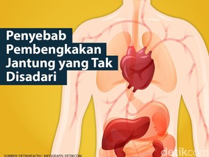 Penyebab Pembengkakan Jantung, Gejala, dan Cara Mengobatinya