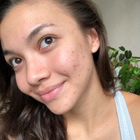 Sebagai public figure, pesinetron Angela Gilsha mengaku merasa perlu untuk memperlihatkan penampilannya aslinya tanpa makeup ataupun filter. Angela mengungkapkan bahwa penampilannya tidak selalu sempurna seperti yang kerap dipuji netizen. Dalam unggahan di Instagramnya pada 2020, Angela memperlihatkan wajahnya yang berjerawat. Foto: Instagram/@angelagilsha