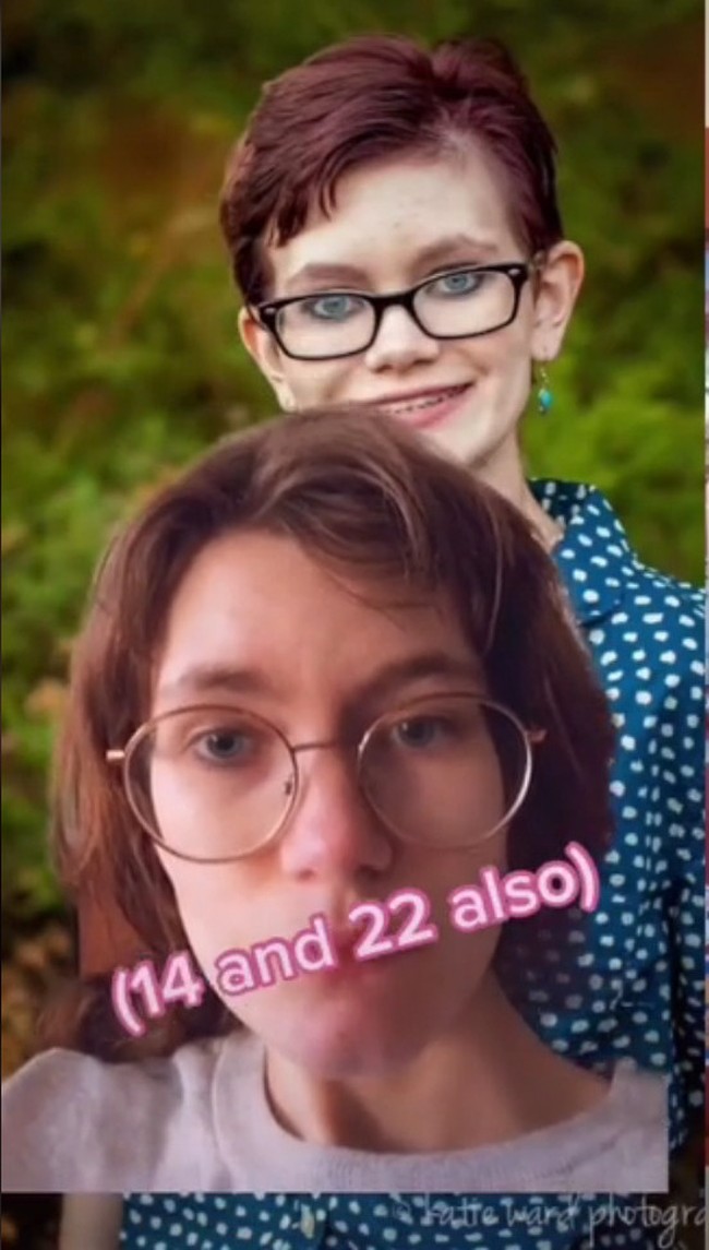 Salah satu contoh kasus Benjamin Button lain yang cukup mengejutkan warga TikTok adalah penampilan @bunnymund saat berusia 14 tahun. Penampilannya di usia 22 tampak jauh lebih muda dibanding ketika remaja. Foto: TikTok