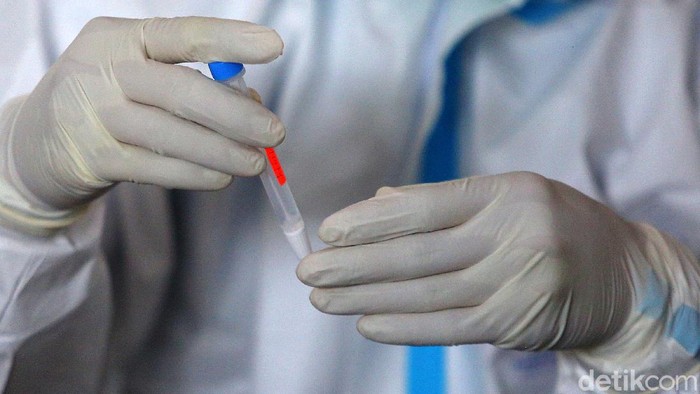 7 Poin Surat Edaran Kemenkes Yang Mengatur Harga Rapid Test Antigen