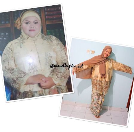 Disebut Gajah Bengkak, Wanita Ini Terpacu Diet hingga Turun 43 Kg!