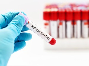 Viral Pasangan Terpaksa Batalkan Nikah Pasca Tahu Idap Thalassemia, Kondisi Apa Itu?