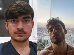 Dulu Dibilang Jelek, Kini Mereka Glow Up