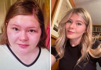 fotoinet dulu jelek sekarang glow up