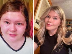 Dulu Dibilang Jelek, Kini Mereka Glow Up