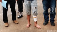 Aldi ditembak kakinya karena melakukan perlawanan saat akan ditangkap.