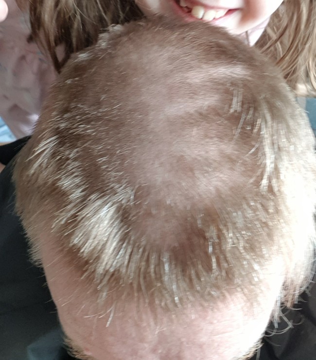 Ini hasil guntingan rambut keponakan yang berusia 7 tahun. Rambutnya pun jadi ikutan social distancing. Foto: Instagram, Twitter