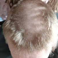 Ini hasil guntingan rambut keponakan yang berusia 7 tahun. Rambutnya pun jadi ikutan social distancing. Foto: Instagram, Twitter