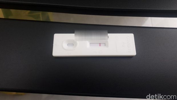 Pengalaman rapid test antigen