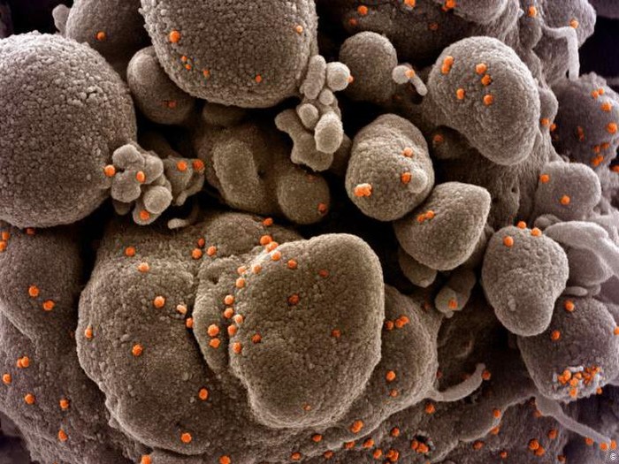 Selain Inggris, Negara-negara Ini juga Deteksi Mutasi Baru Virus Corona