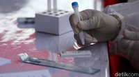 Sampel yang didapat lalu dimasukkan ke suatu tempat, lalu diteteskan ke alat yang mirip test pack kehamilan.