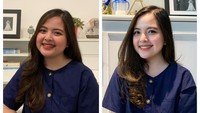 Yang paling baru adalah Tasya Kamila. Tasya Kamila berhasil menurunkan berat badannya dengan melakukan diet sehat. Penampilannya bikin pangling. Foto: instagram