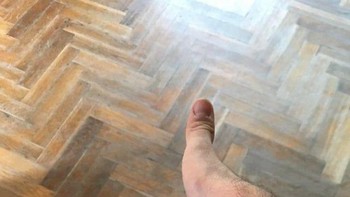 Ini kaki atau tangan? (Foto: Reddit)