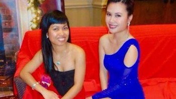 Tangan tidak buntung kok. Ayo lihat lagi foto ini dua kali (Foto: Reddit)