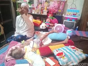 Kasihan, Tangan Bocah 5 Tahun di Madiun Ini Membesar Karena Kanker Tulang