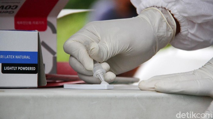 Polda Metro Jaya mengadakan rapid test antigen gratis dalam Operasi Lilin Jaya 2020. Salah satu lokasi rapid test antigen berada di pos wilayah Cilandak.