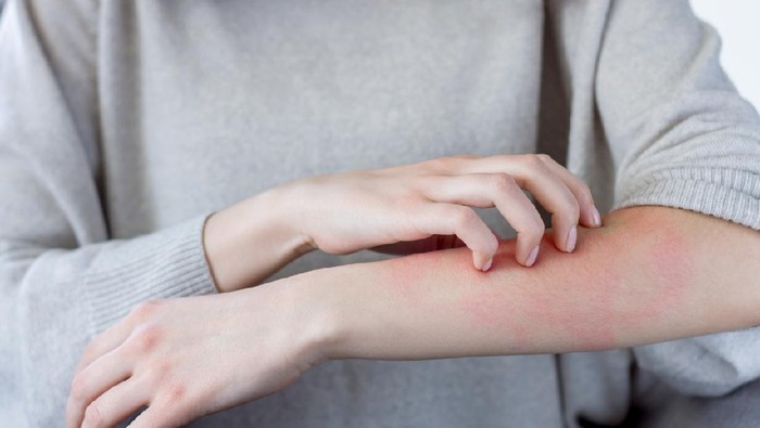 Gatal pada kulit terutama malam hari merupakan gejala dari penyakit
