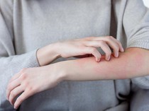 Waspada! Jika Muncul Gejala Ini di Kulit, Bisa Jadi Tanda Penyakit Ginjal