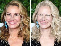 Potret Wajah Seleb Dunia Jika Diedit Albino