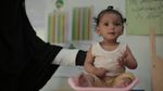 COVID-19 di Negara Konflik Picu Malnutrisi Anak-anak