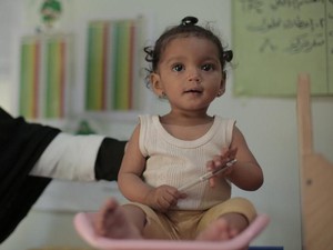 Malnutrisi Adalah: Ciri dan Penyebabnya