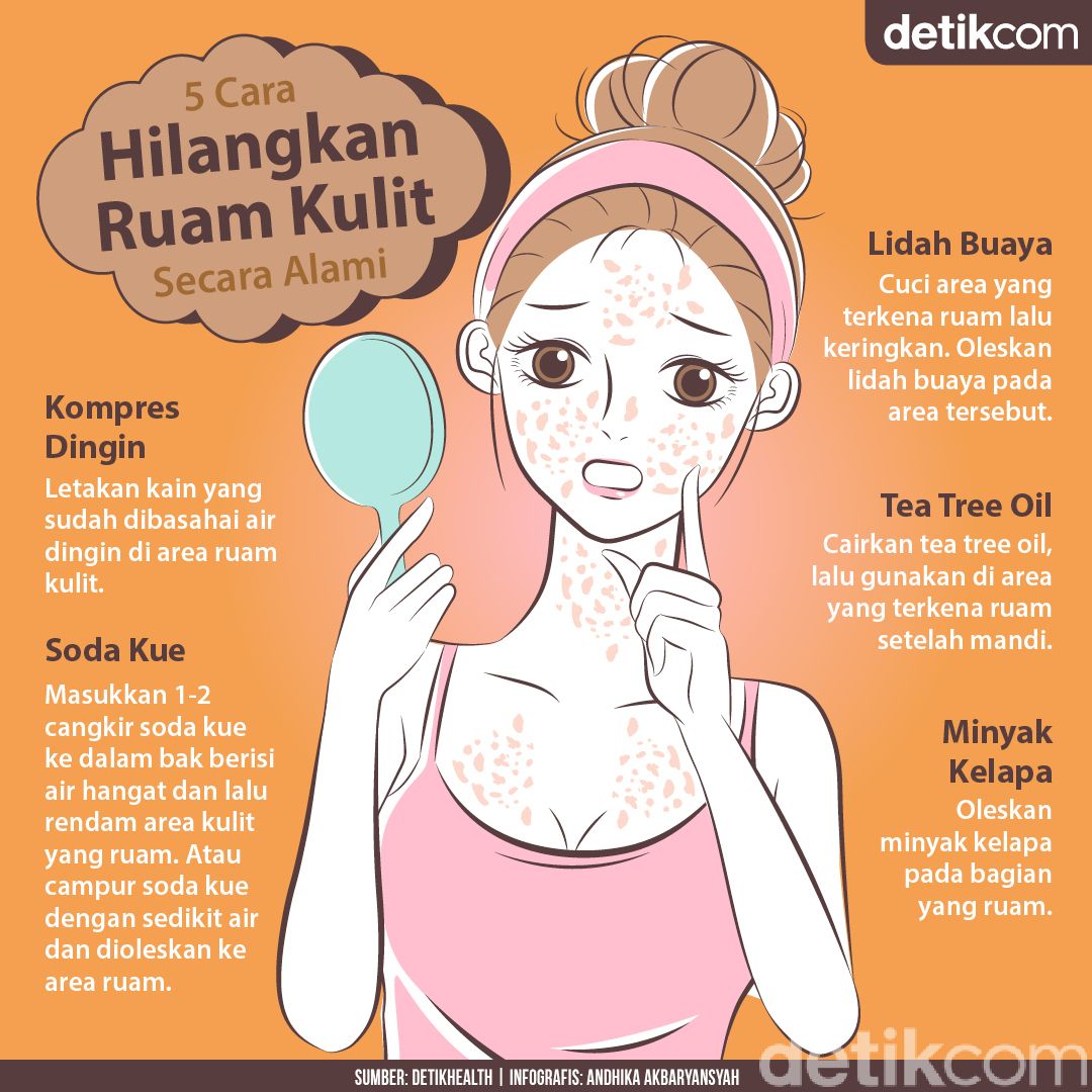 Jadi Salah Satu Gejala COVID-19, Begini Menghilangkan Ruam Kulit