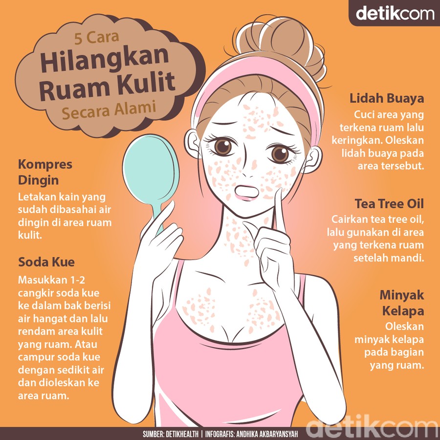 Jadi Salah Satu Gejala COVID-19, Begini Menghilangkan Ruam Kulit Jadi Salah Satu Gejala COVID-19, Begini Menghilangkan Ruam Kulit