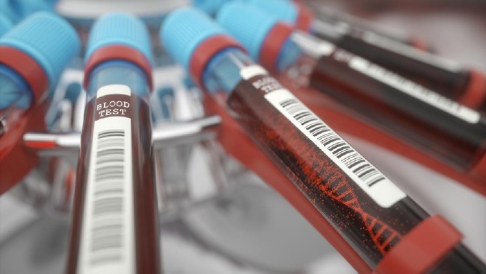 tes darah 3D illustration, conceptual image. Molecule of DNA forming inside the test tube in the blood test equipment.