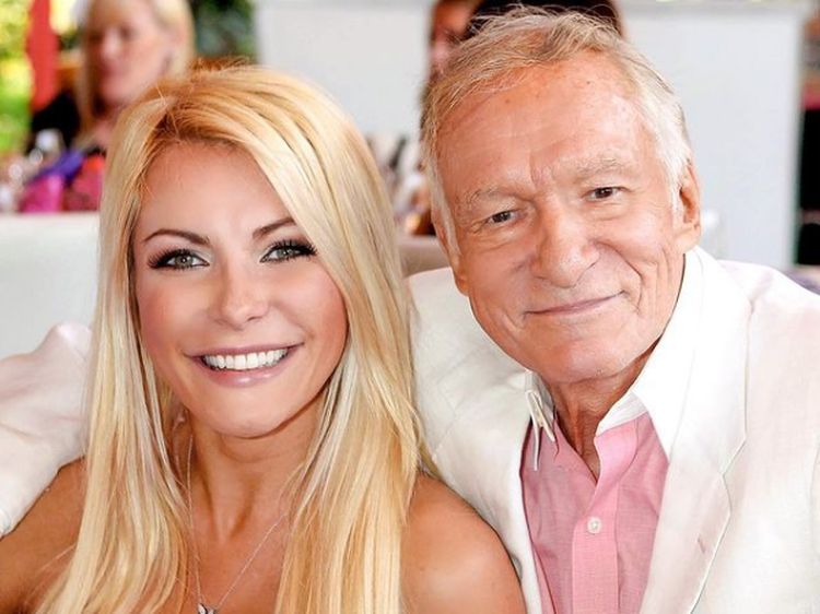 Potret Mantan Model Playboy yang Nyaris Tewas karena Operasi Transfer Lemak