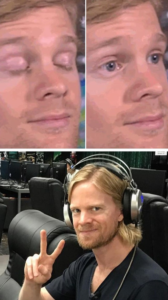 Blinking White Guy Drew ScanlonPria yang sering muncul dalam gif ini adalah Drew Scanlon. Ia jadi viral setelah gambarnya saat live streaming di website gaming bernama Giant Bomb diambil ketika ia berprofesi sebagai produser. Foto: Dok. Internet/Twitter Drew Scanlon